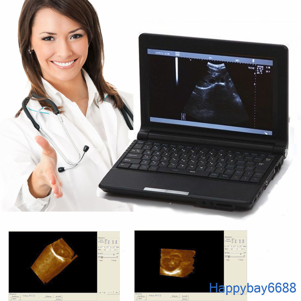 Nootbook 10 Inch Laptop Ultrasound Scanner Linear Probe 3D Ultrasonic Machine 190891999917 DIAGNOSTIC ULTRASOUND MACHINES FOR SALE