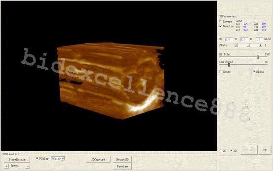 Portable Laptop Ultrasound Scanner Diagnostic machine Convex Probe 3D OximeterAA 190891895424 DIAGNOSTIC ULTRASOUND MACHINES FOR SALE