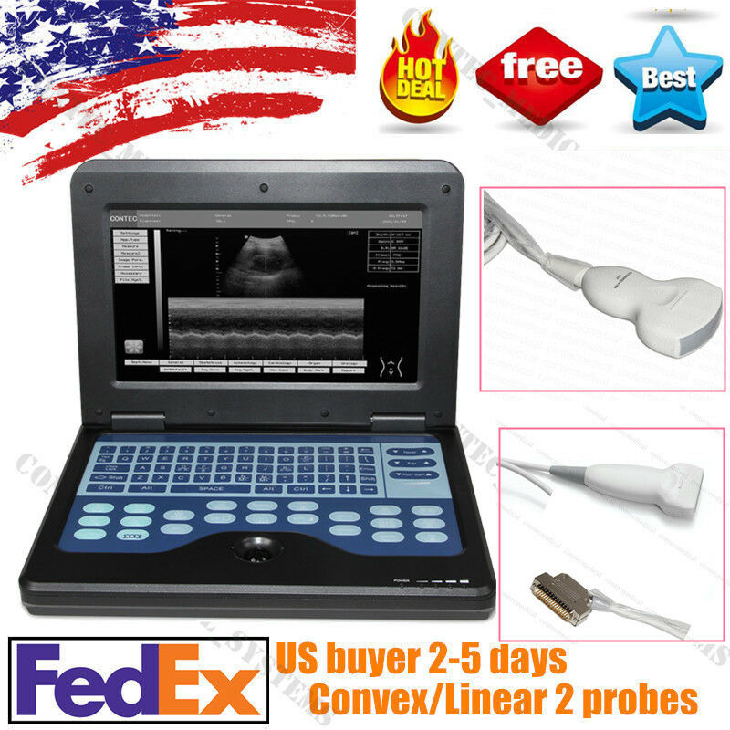 Portable Laptop Ultrasound Scanner Machine Human 2 Probes 3.5 Convex+ 7.5 Linear DIAGNOSTIC ULTRASOUND MACHINES FOR SALE
