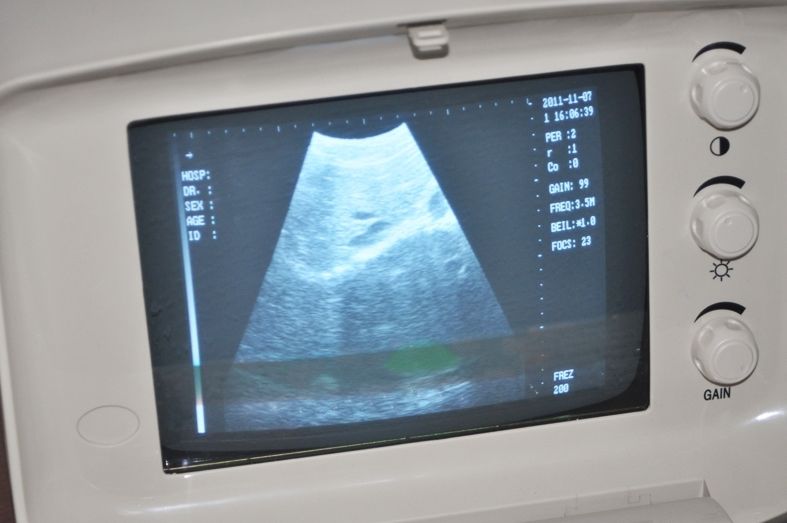 Digital Ultrasound Scanner Machine Convex +Linear 2 Probes Free 3D Software CE 190891732316 DIAGNOSTIC ULTRASOUND MACHINES FOR SALE