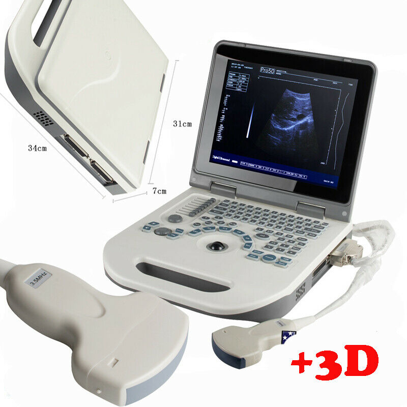 Portable Laptop Digital Ultrasound Scanner Machine with 3.5MHz Convex Probe+3D DIAGNOSTIC ULTRASOUND MACHINES FOR SALE