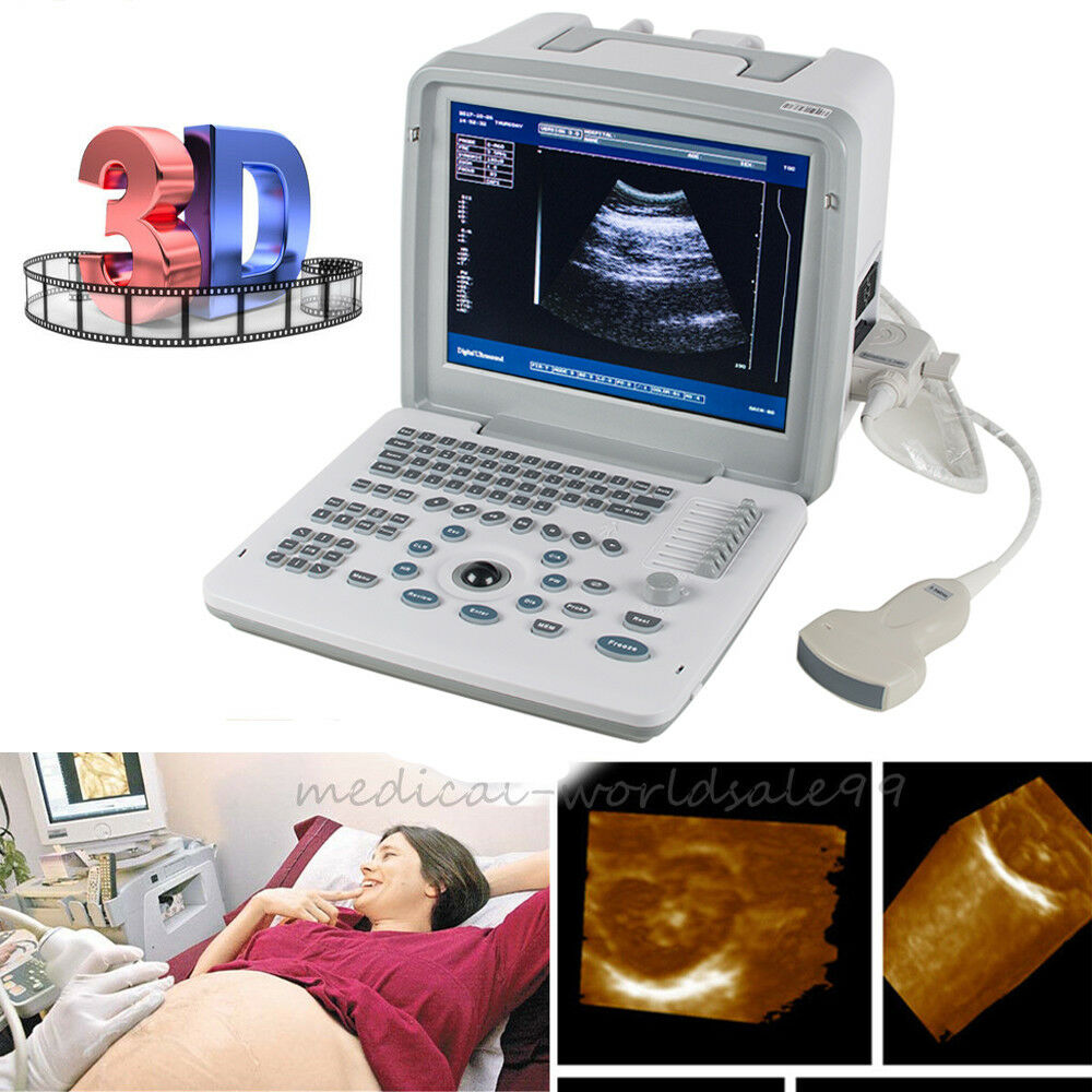 Sonography Digital Portable Ultrasound Scanner Machine with Convex Probe Free 3D 190891344144 DIAGNOSTIC ULTRASOUND MACHINES FOR SALE