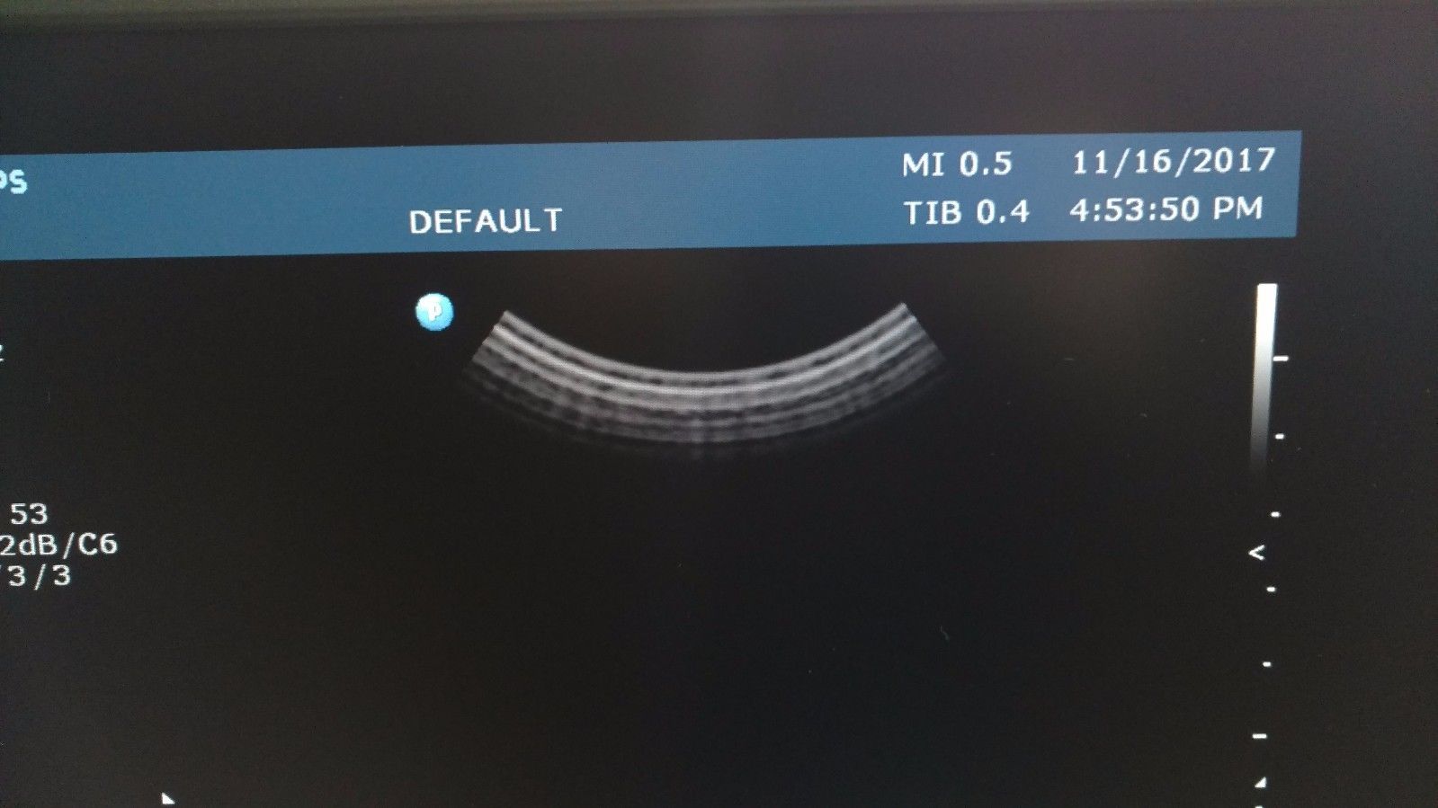 a computer screen with a curved arrow on it