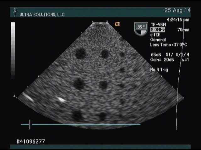 Acuson TE-V5Ms Pinless Ultrasound Probe DIAGNOSTIC ULTRASOUND MACHINES FOR SALE