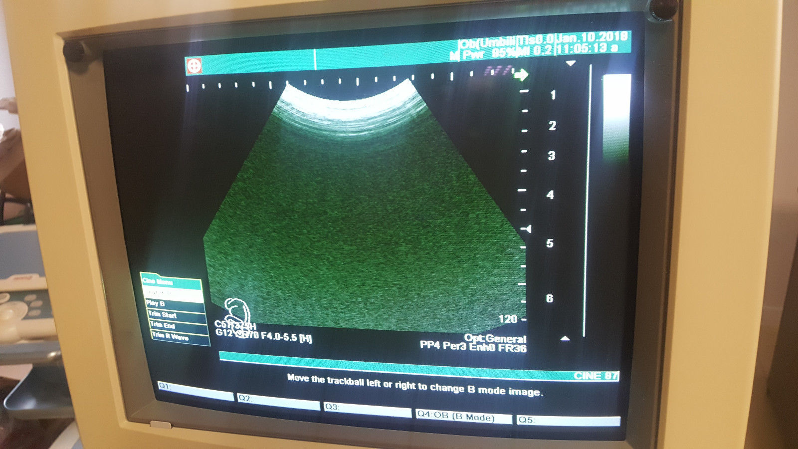 Shimadzu SDU-1200Pro Diagnostic Ultrasound unit 541-50049-03 OB, GYN, DIAGNOSTIC ULTRASOUND MACHINES FOR SALE