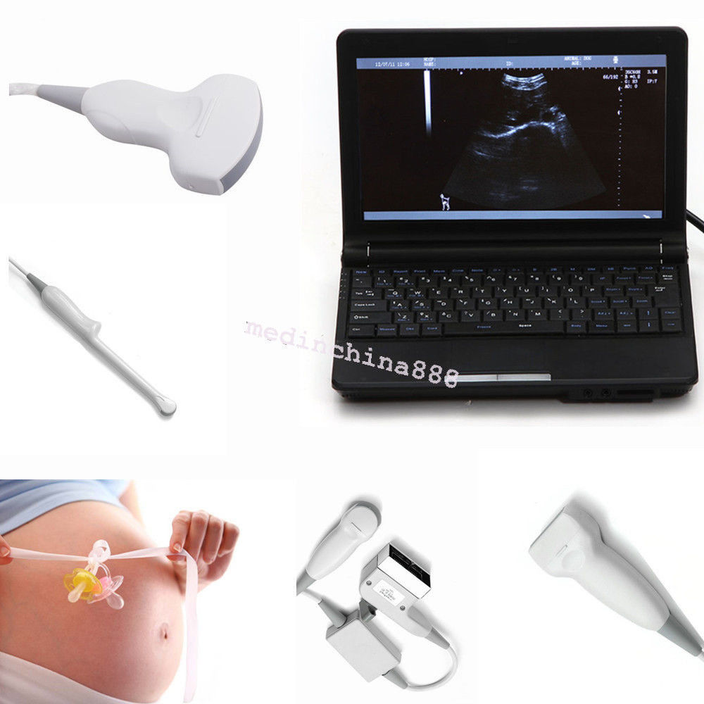 New 10.1'' Ultrasound Scanner With Convex+Linear+Transvaginal+Micro-convex Probe DIAGNOSTIC ULTRASOUND MACHINES FOR SALE