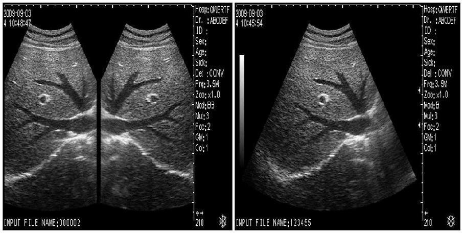 With 3D worksation Portable Ultrasound Scanner Machine Linear Probe DHL A+ 190891776525 DIAGNOSTIC ULTRASOUND MACHINES FOR SALE