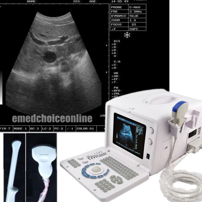 Portable Digital Ultrasound Scanner Machine Convex &Transvaginal 2 Probes CE 3D 190891918765 DIAGNOSTIC ULTRASOUND MACHINES FOR SALE