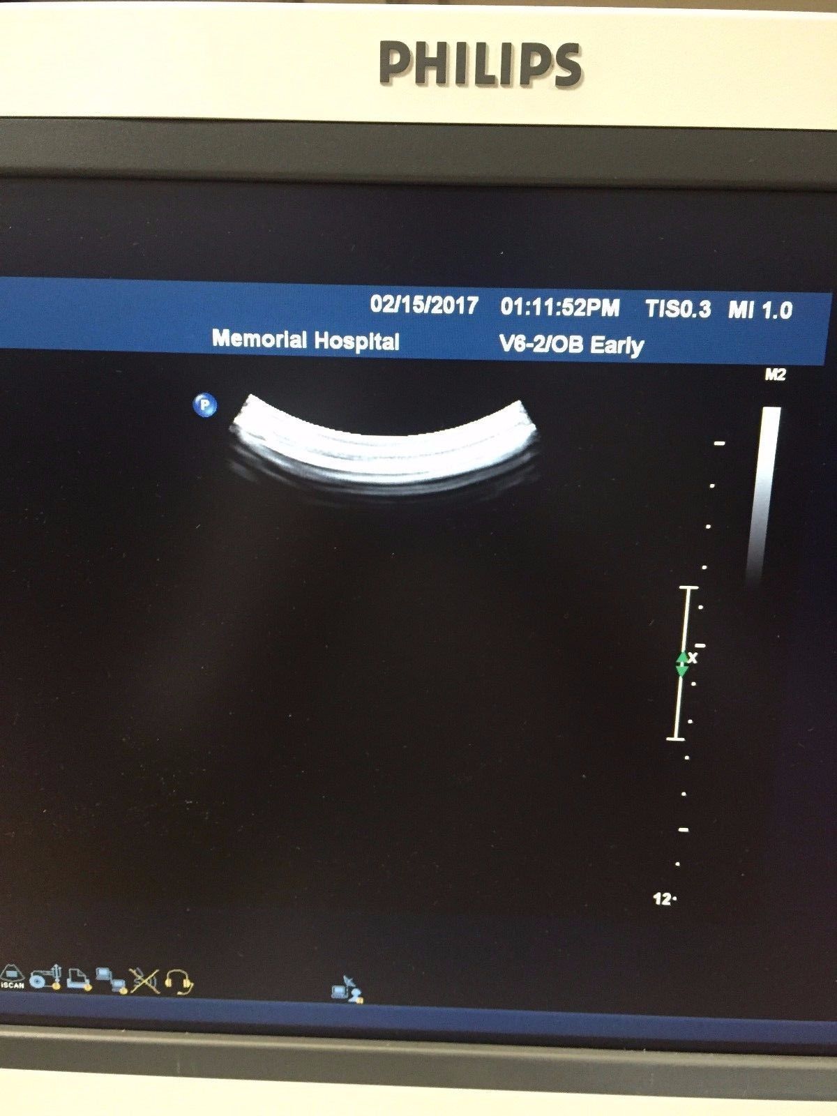 Philips V6-2 Curved Volume Array Ultrasound Transducer for Philips iU22 DIAGNOSTIC ULTRASOUND MACHINES FOR SALE