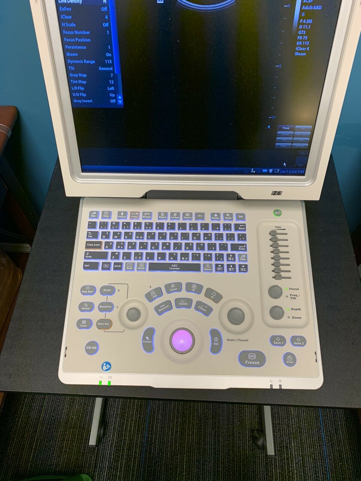 MINDRAY Z6 Portable Ultrasound Machine DIAGNOSTIC ULTRASOUND MACHINES FOR SALE