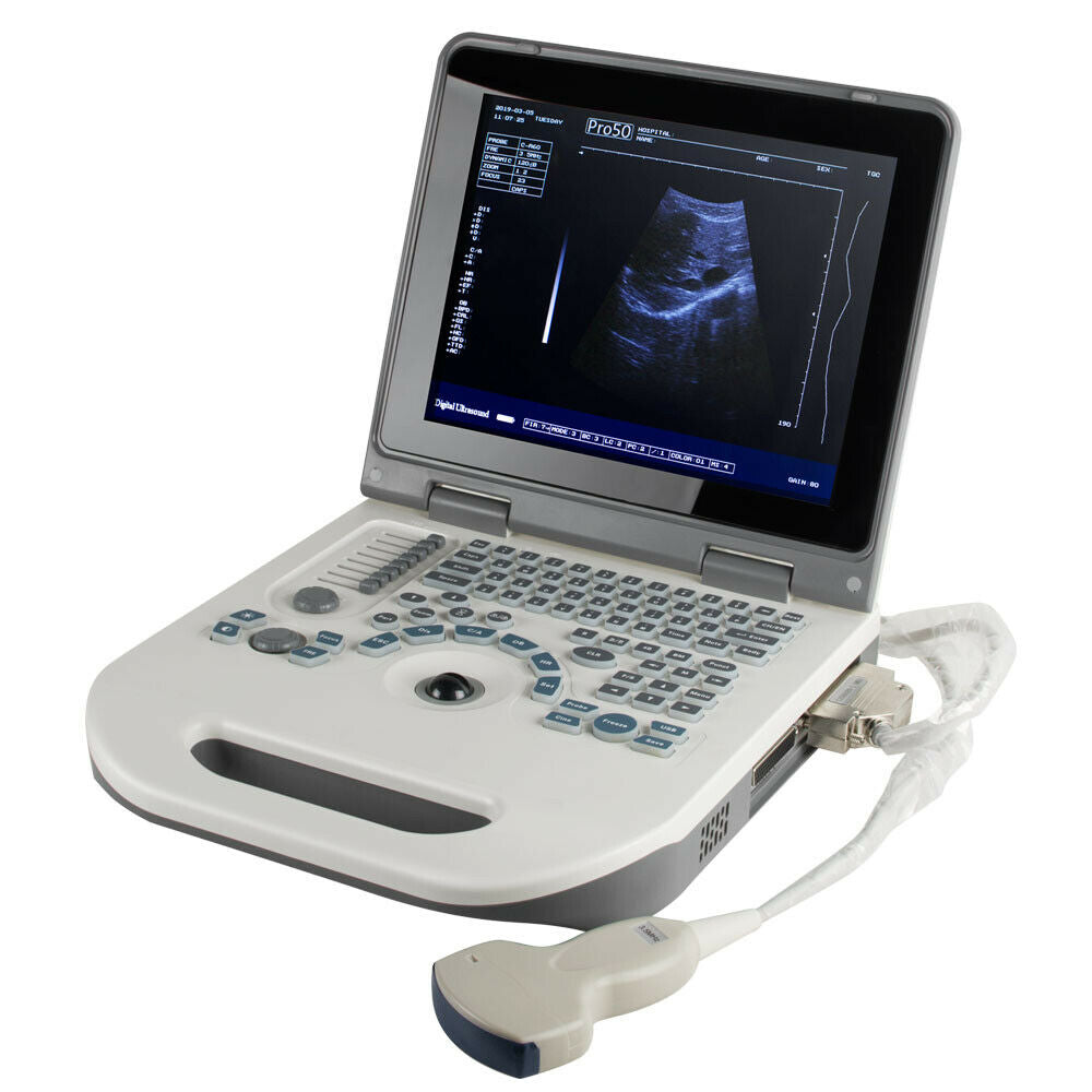 Portable Digital Ultrasound Scanner machine Abdomen Baby Convex Probe + 3D Pack DIAGNOSTIC ULTRASOUND MACHINES FOR SALE