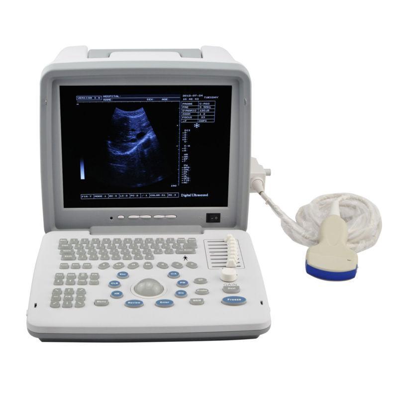 Full Digital Ultrasound Scanner Machine With Convex Transvaginal Probe +3D Image 190891911506 DIAGNOSTIC ULTRASOUND MACHINES FOR SALE