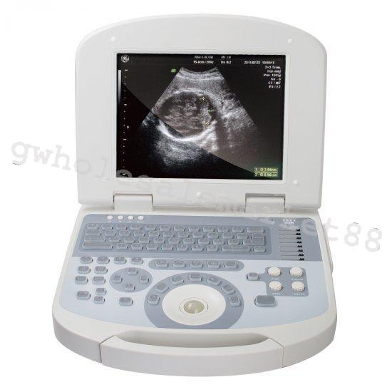 USA High Resolution Digital Laptop Medical Ultrasound Scanner Convex probe +3D 190891422491 DIAGNOSTIC ULTRASOUND MACHINES FOR SALE