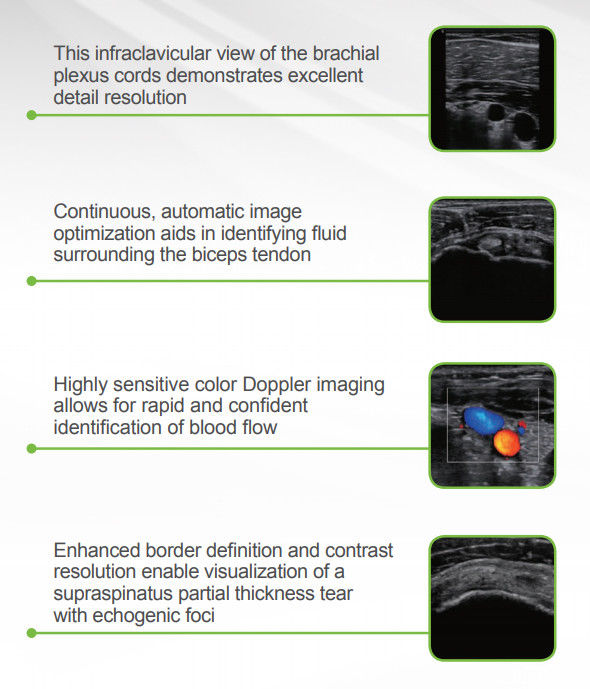 NEW EDAN AX7 Portable Ultrasound System DIAGNOSTIC ULTRASOUND MACHINES FOR SALE