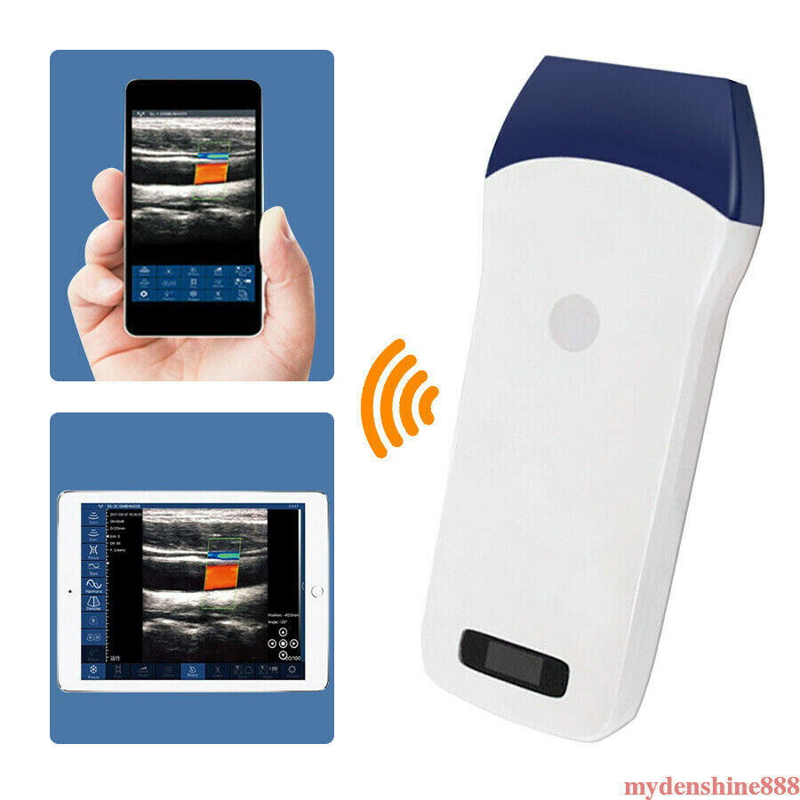 Portable WIFI Wireless Color Doppler Ultrasound Scanner 7.5Mhz Linear Probe 128E DIAGNOSTIC ULTRASOUND MACHINES FOR SALE