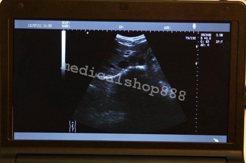 Sale! 10Inch Laptop Ultrasound Scanner with linear probe 3D Ultrasound Device 190891478627 DIAGNOSTIC ULTRASOUND MACHINES FOR SALE
