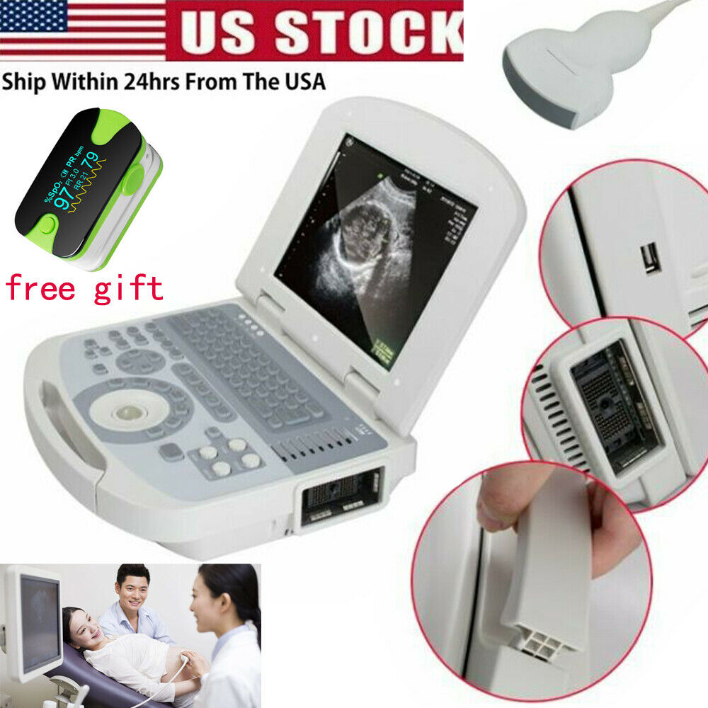 Portable Digital Laptop Medical Ultrasound Scanner Machine+3.5 Convex probe+Gift DIAGNOSTIC ULTRASOUND MACHINES FOR SALE