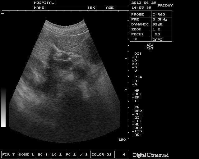 Profession Digital Ultrasound Scanner Convex Probe 3D software Optional Linear 190891927064 DIAGNOSTIC ULTRASOUND MACHINES FOR SALE