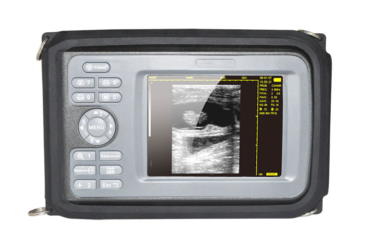 Digital LCD Check System Ultrasound Scanner Monitoring with linear Probe US Ship 190891417756 DIAGNOSTIC ULTRASOUND MACHINES FOR SALE