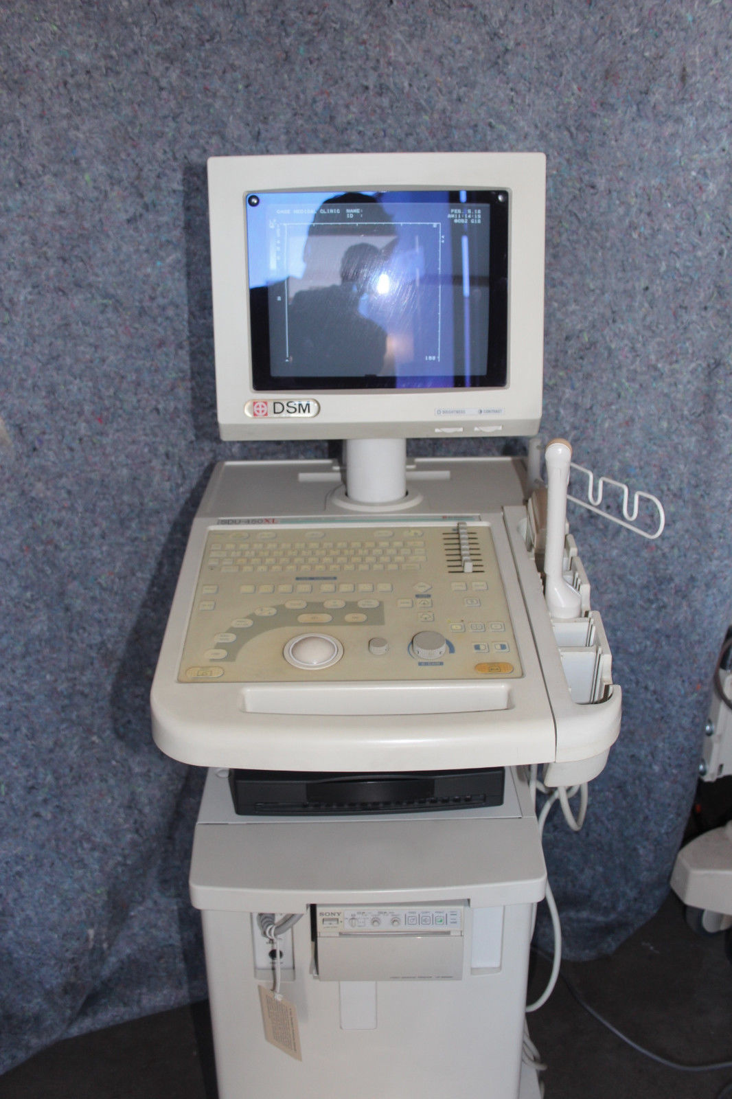 Shimadzu Diagnostic Ultrasound system SDU-450XL w/ two probes DIAGNOSTIC ULTRASOUND MACHINES FOR SALE