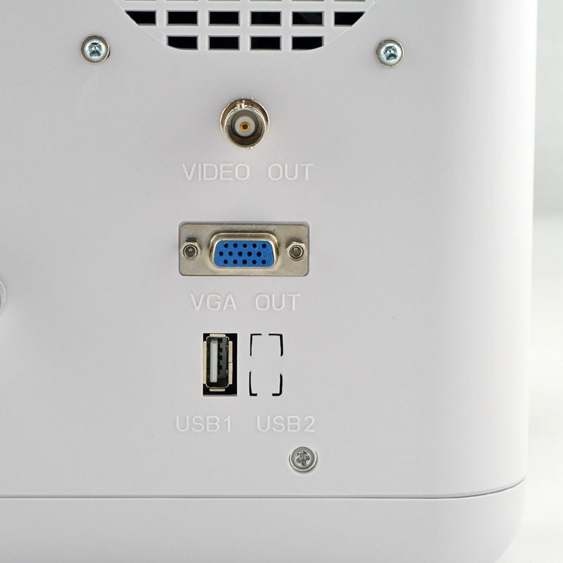 Medical 3D Digital Portable Ultrasound Scanner 3.5M Convex + 7.5M Linear 2 Probe DIAGNOSTIC ULTRASOUND MACHINES FOR SALE