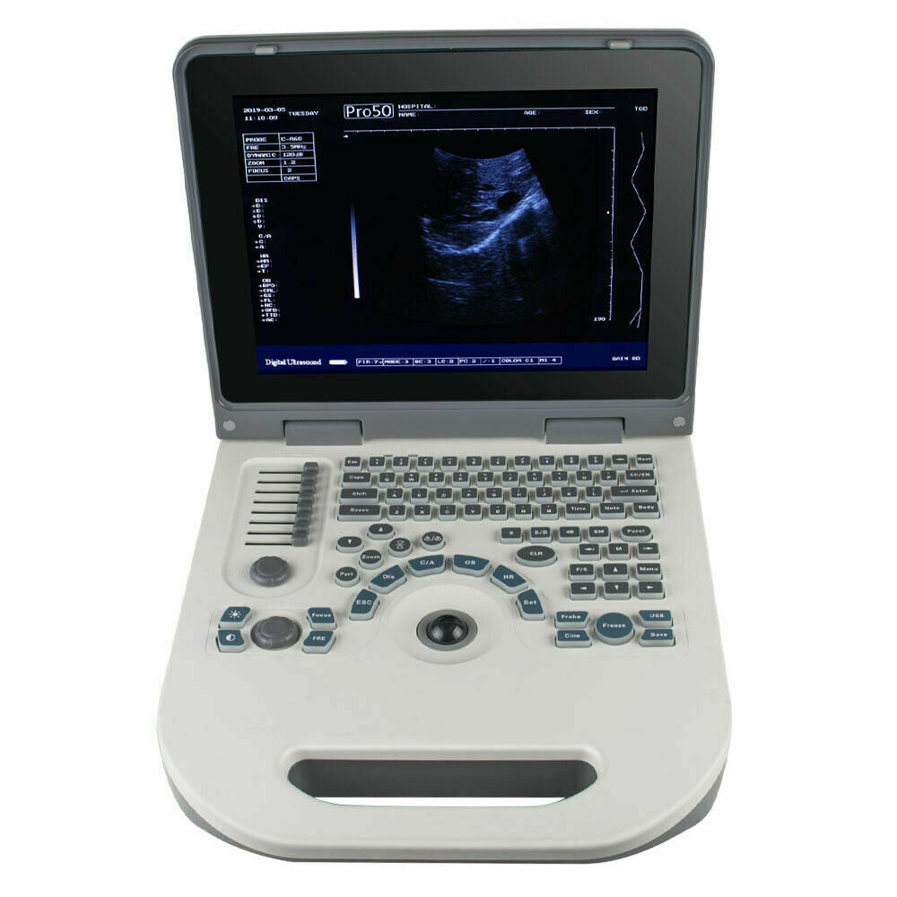 Portable Digital Ultrasound Scanner Ultrasonic MachineDisgnos Convex Probe 3D CE DIAGNOSTIC ULTRASOUND MACHINES FOR SALE