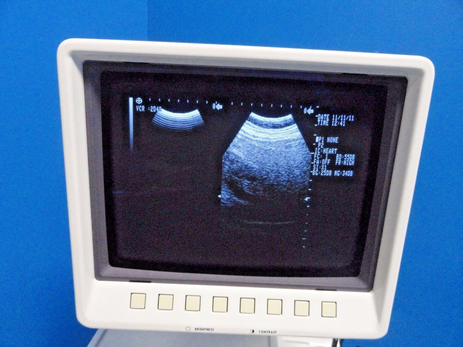 Shimadzu VA40R-035U 3.5 MHz 40mm Convex Probe for SDU-1100 SDU-400 SDU-450~13538 DIAGNOSTIC ULTRASOUND MACHINES FOR SALE