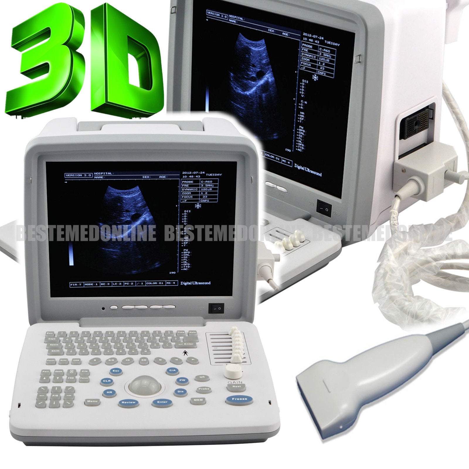 Hospital Digital Ultrasound Ultrasonic Scanner Device 7.5 Mhz Linear Probe 3D 190891990112 DIAGNOSTIC ULTRASOUND MACHINES FOR SALE