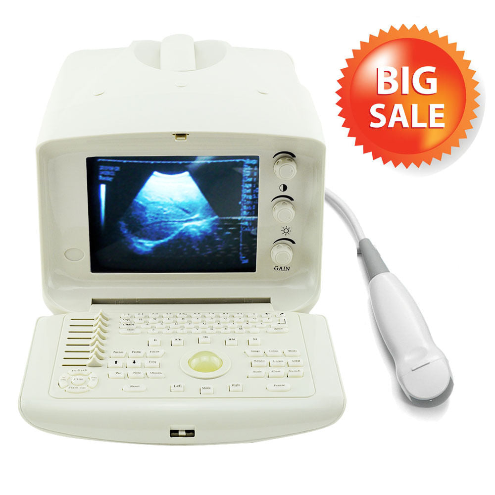Portable Digital Ultrasound Scanner Machine System 5.0MHz Micro Convex Probe 3D 190891303288 DIAGNOSTIC ULTRASOUND MACHINES FOR SALE