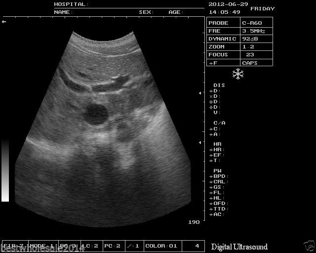 veterinarian B Ultrasound Scanner Machine Micro-convex Array Probe Animals 3D 190891743565 DIAGNOSTIC ULTRASOUND MACHINES FOR SALE