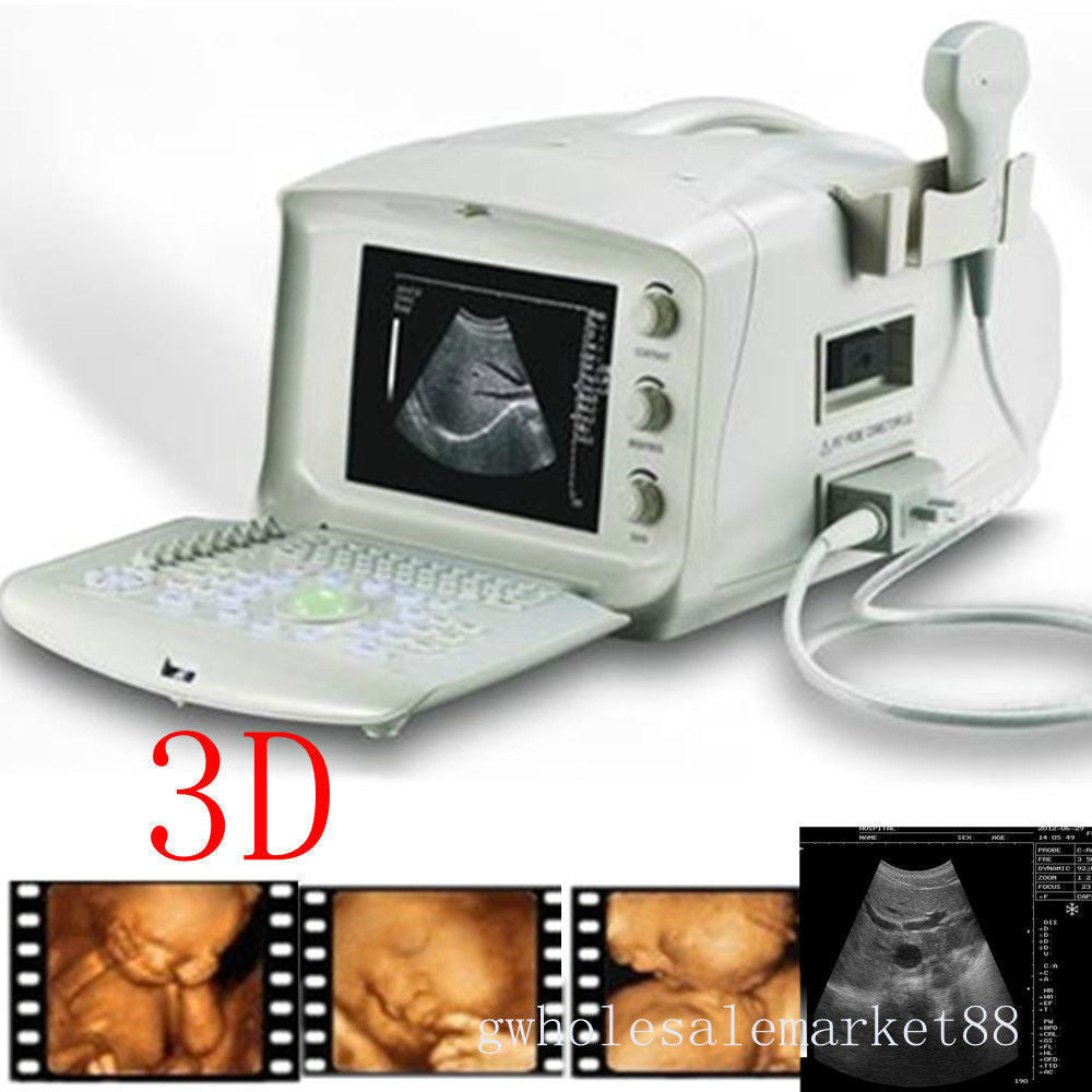 Portable Machine Digital Ultrasound Scanner Transvaginal Probe -EXT 3D Software 190891982230 DIAGNOSTIC ULTRASOUND MACHINES FOR SALE