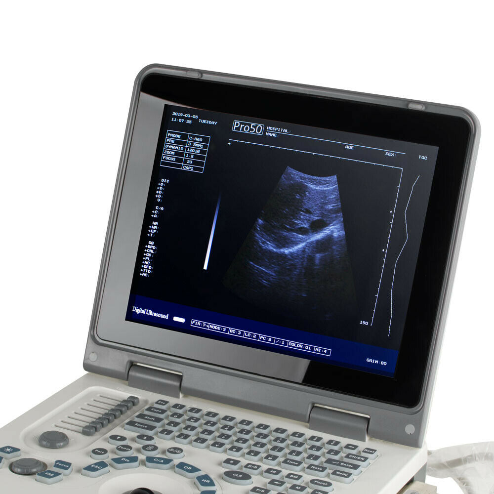 Portable Ultrasound Scanner Laptop Machine Safty Ultrasonic System+Convex Probe DIAGNOSTIC ULTRASOUND MACHINES FOR SALE