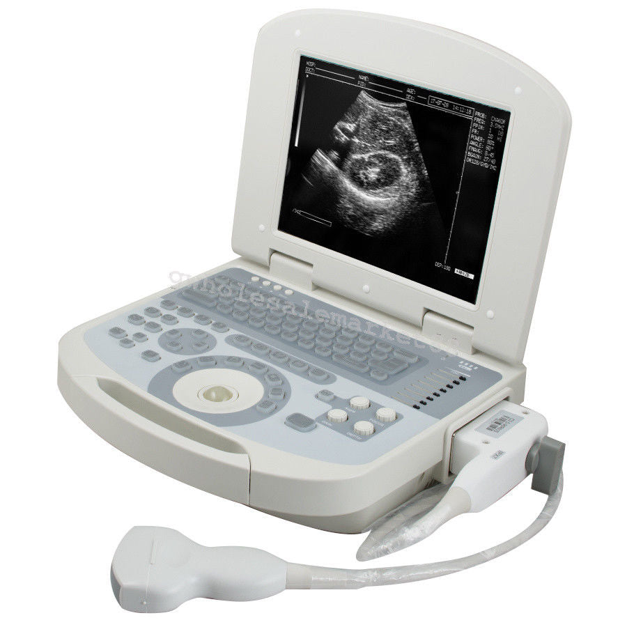 Portable Ultrasound Machine Scanner System Convex probe 3D Software Image Photo 190891045898 DIAGNOSTIC ULTRASOUND MACHINES FOR SALE