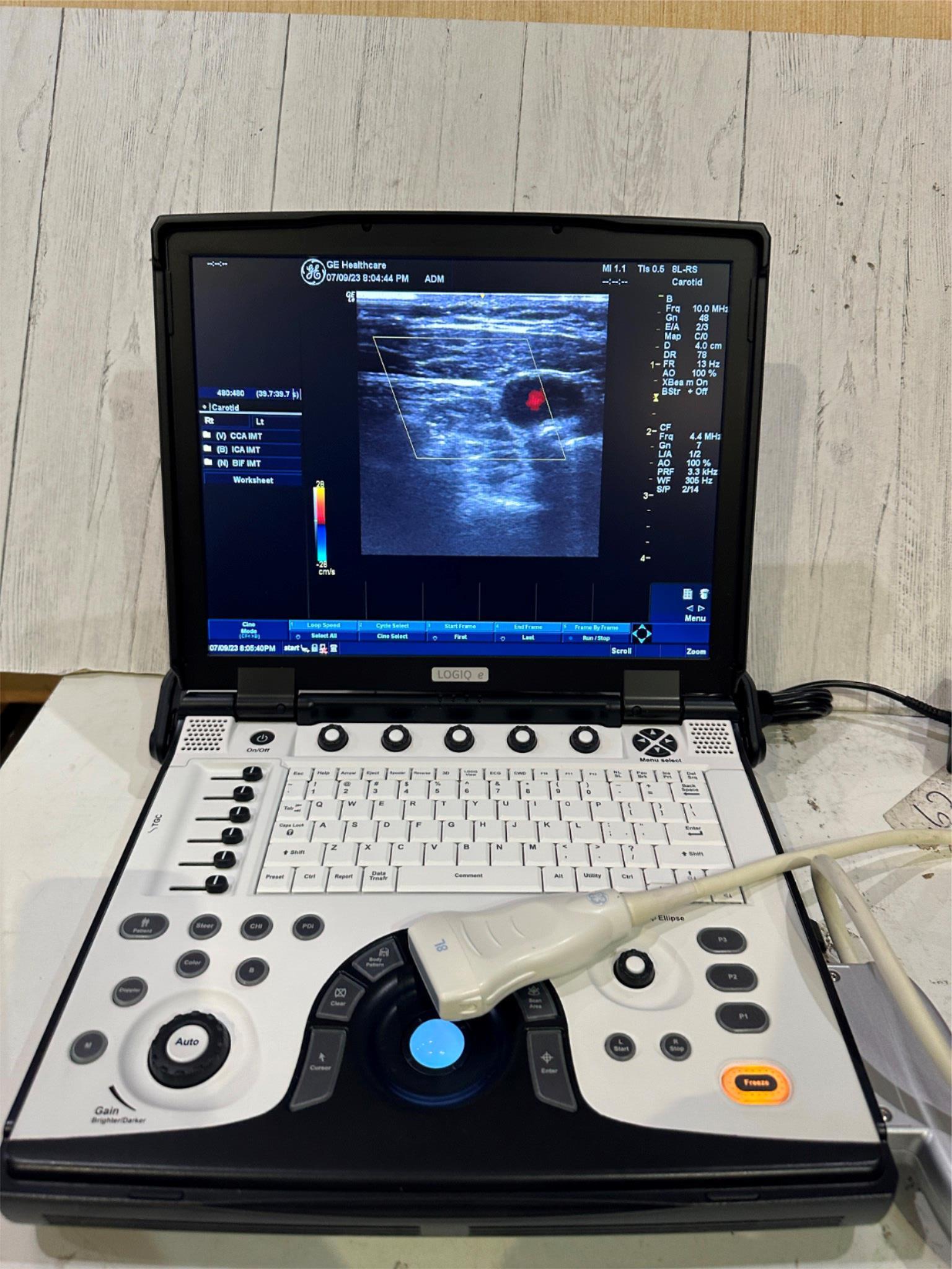 BT12 GE LOGIQ E Next Ge Ultrasound 2013, Vascular & 8L-RS probe DIAGNOSTIC ULTRASOUND MACHINES FOR SALE