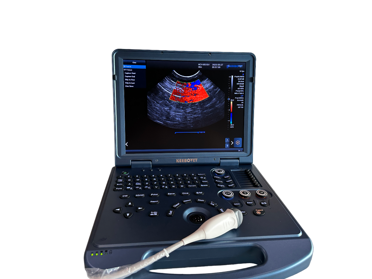 ECO-17Vet High end Equine Ultrasound with Rectal Probe  4-12 MHz Color Doppler DIAGNOSTIC ULTRASOUND MACHINES FOR SALE