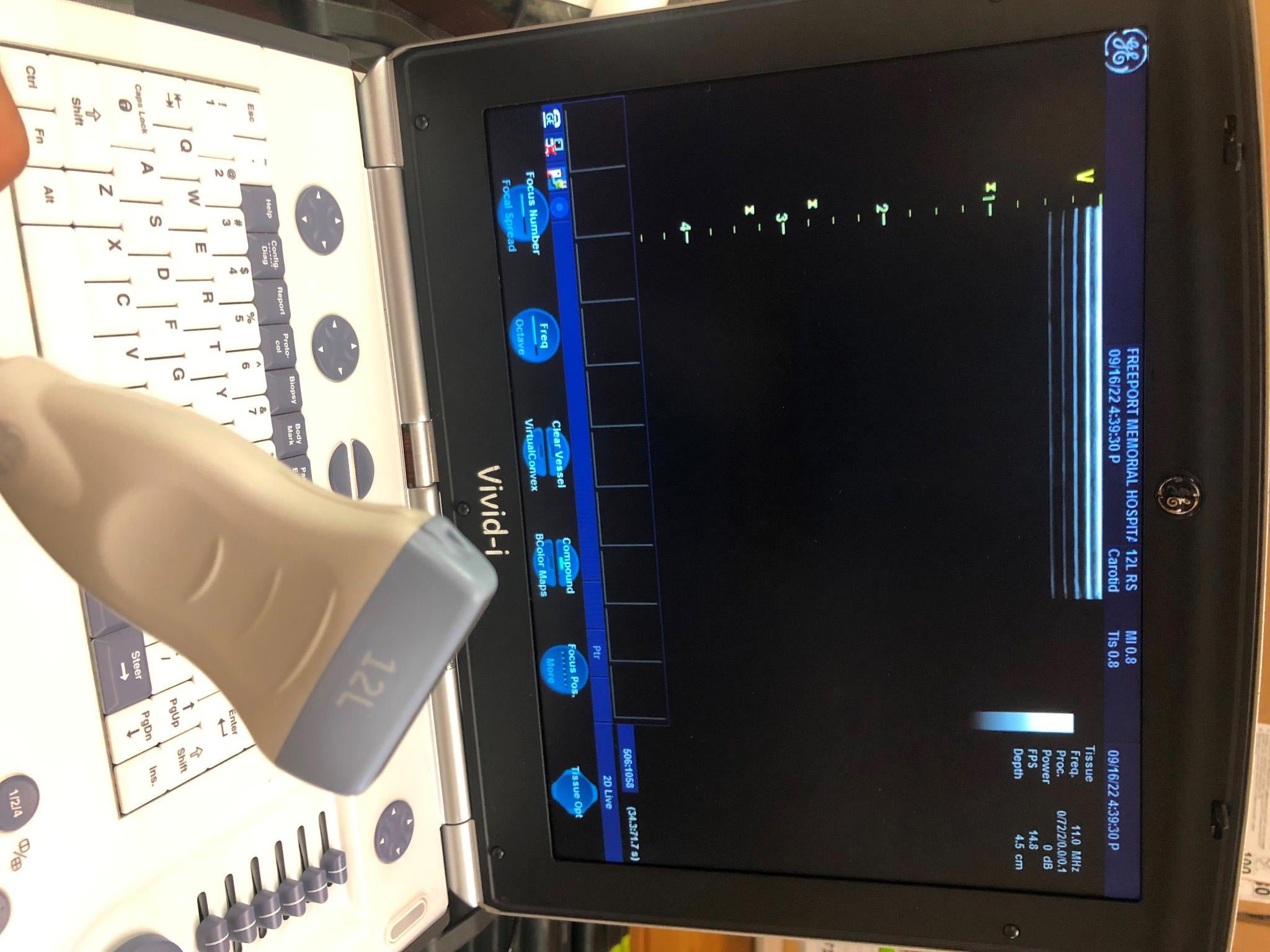 GE 12L-RS Ultrasound probe Transducer DIAGNOSTIC ULTRASOUND MACHINES FOR SALE
