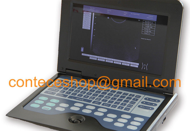 Portable Laptop Machine Digital Ultrasound Scanner, probe, human/vet, USA Fedex DIAGNOSTIC ULTRASOUND MACHINES FOR SALE