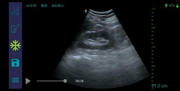 MX5 Go Portable Ultrasound The World’S First App-Based Swine Ultrasound DIAGNOSTIC ULTRASOUND MACHINES FOR SALE