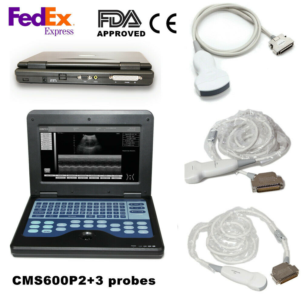 Portable Ultrasound Scanner Laptop Machine with 3 Probes,Convex/ Linear/ Cardiac DIAGNOSTIC ULTRASOUND MACHINES FOR SALE