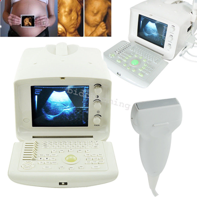 LCD digital potable Ultrasound Scanner monitor + Linear probe + 3D work station 190891664204 DIAGNOSTIC ULTRASOUND MACHINES FOR SALE