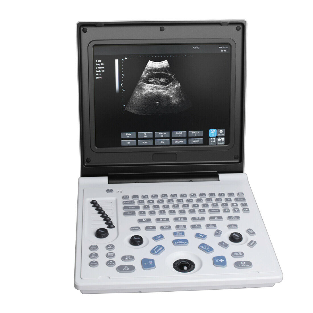 Portable 12 inch Digital Ultrasound Scanner Diagnostic Heart Rate System 3.5MHz DIAGNOSTIC ULTRASOUND MACHINES FOR SALE