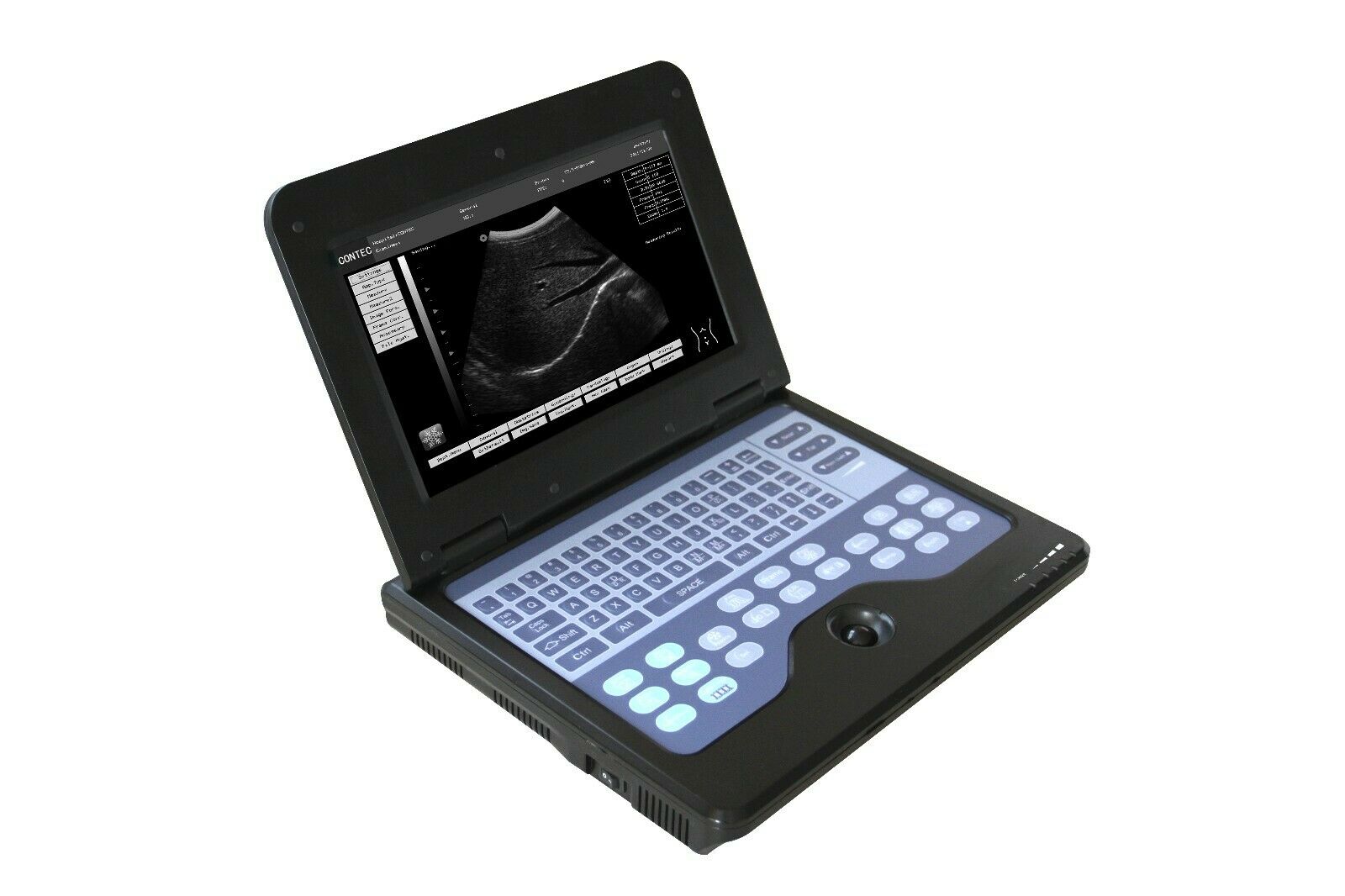 Portable Ultrasound Scanner Diagnostic Device Machine Convex / Linear 2 Probes DIAGNOSTIC ULTRASOUND MACHINES FOR SALE