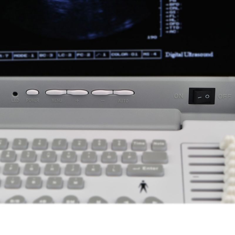 Clear 3D Portable Ultrasound Scanner Machine Convex Linear Transvaginal 3 Probes 190891669940 DIAGNOSTIC ULTRASOUND MACHINES FOR SALE