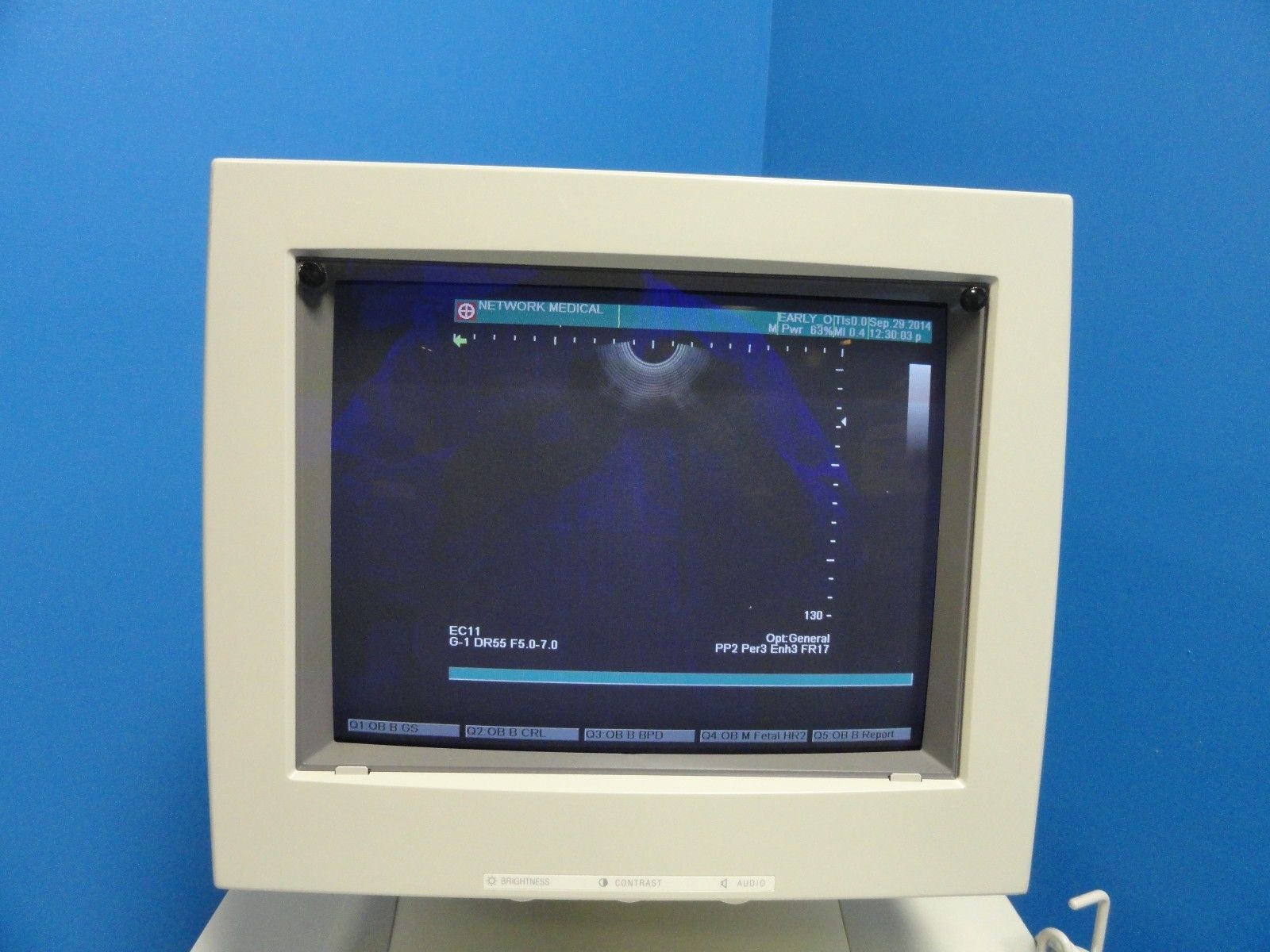 2008 SHIMADZU SDU-1100 DIAGNOSTIC ULTRASOUND W/ VA57R-0375WU & EC11R-055U PROBES DIAGNOSTIC ULTRASOUND MACHINES FOR SALE