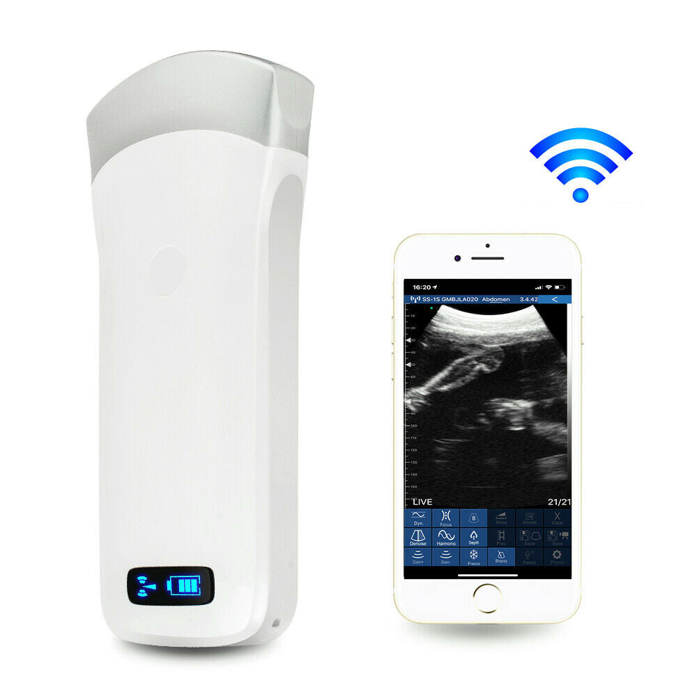 Portable Ultrasound Scanner Convex Array Probe 3.5Mhz 80 Elements +16 Channel CE DIAGNOSTIC ULTRASOUND MACHINES FOR SALE