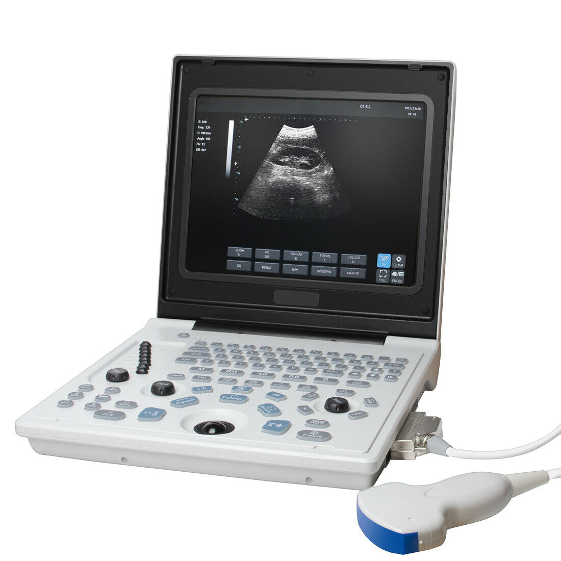 Portable 12''LED Screen Full Digital Ultrasound Scanner + 3.5MHz Convex Probe DIAGNOSTIC ULTRASOUND MACHINES FOR SALE