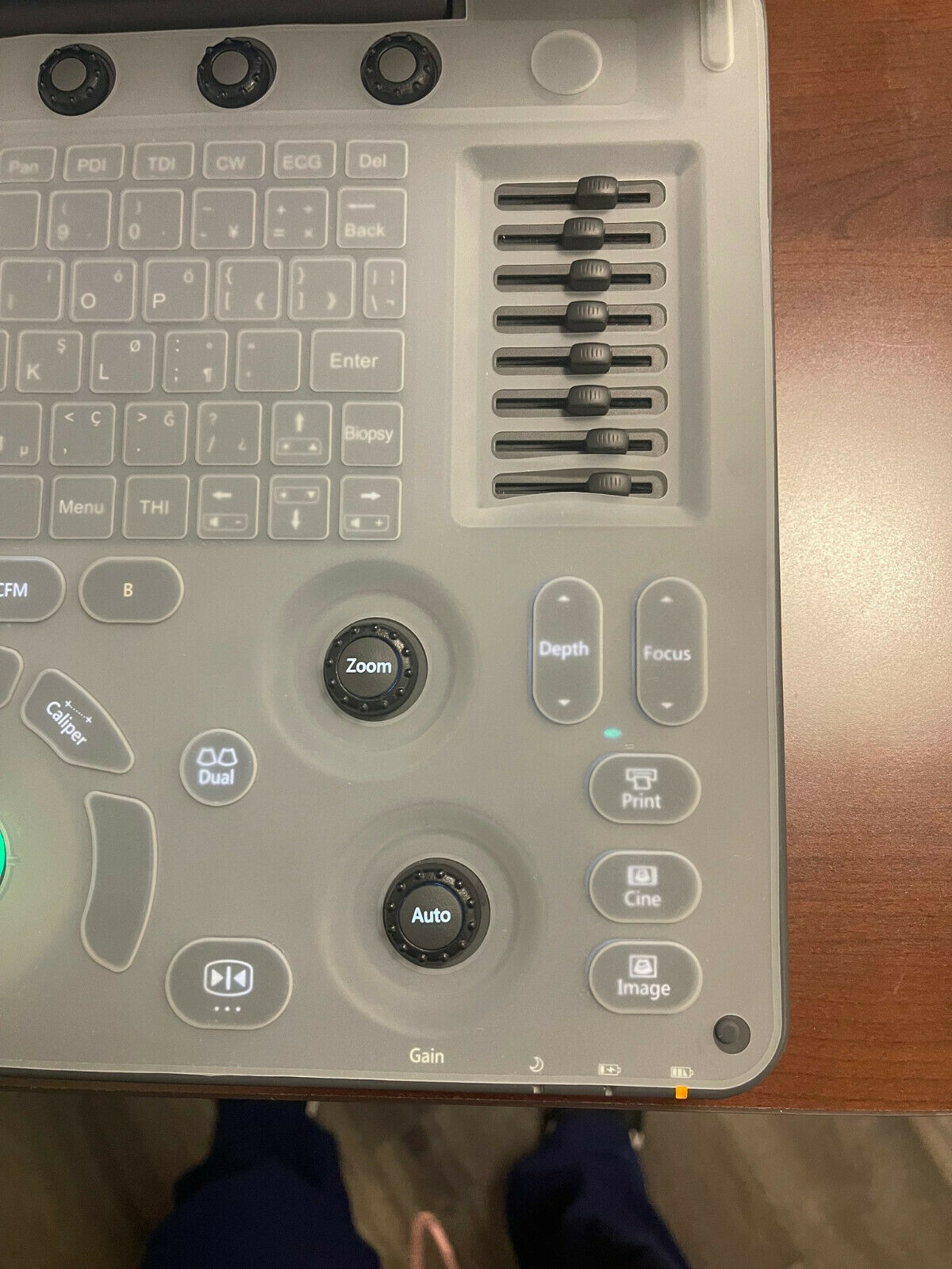 Sonoscape EXP Ultrasound Used, in Excellent condition, only used for 6 Months DIAGNOSTIC ULTRASOUND MACHINES FOR SALE