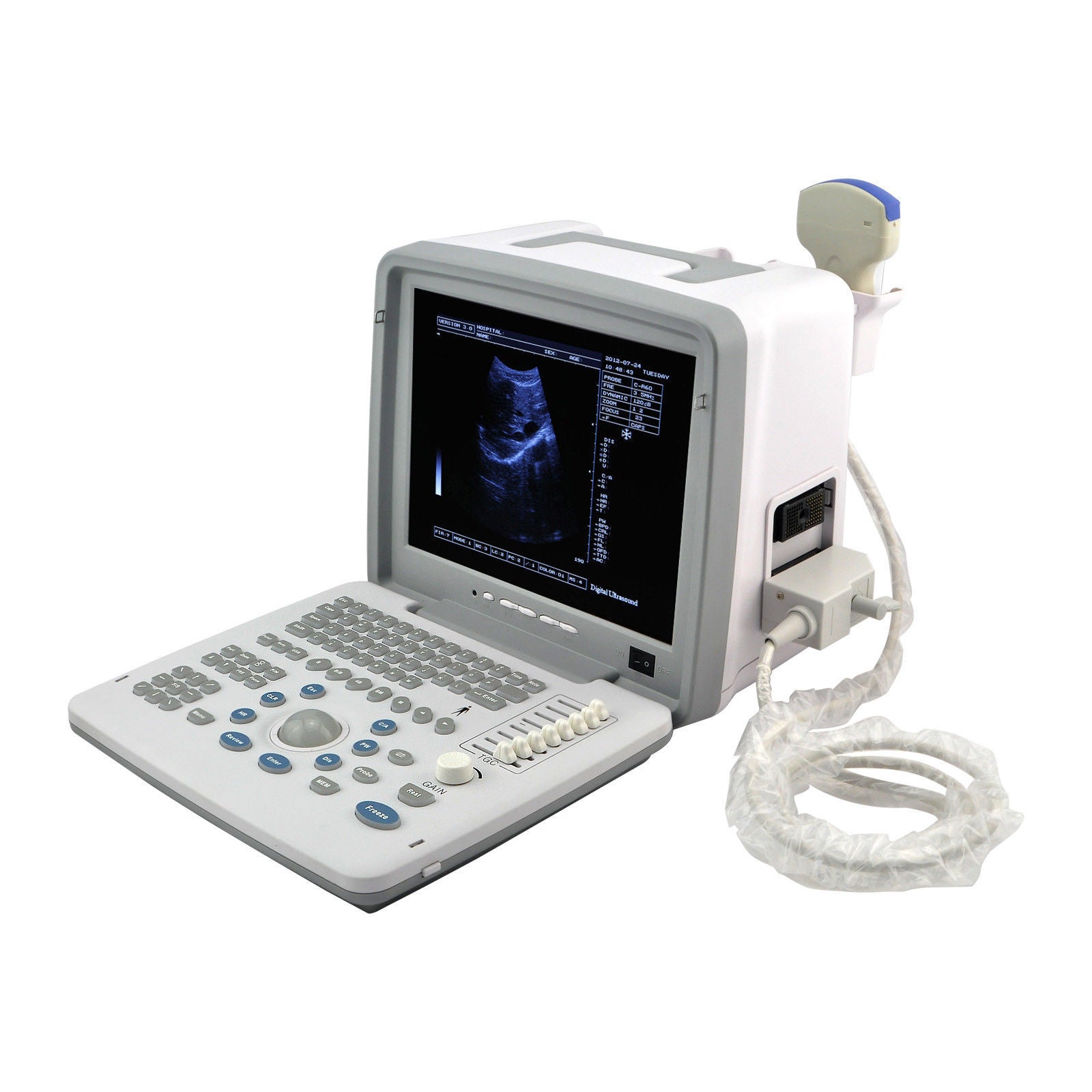 Portable 12'' SVGA LCD Digital Ultrasound Scanner System Convex Linear Probes 3D 190891802217 DIAGNOSTIC ULTRASOUND MACHINES FOR SALE