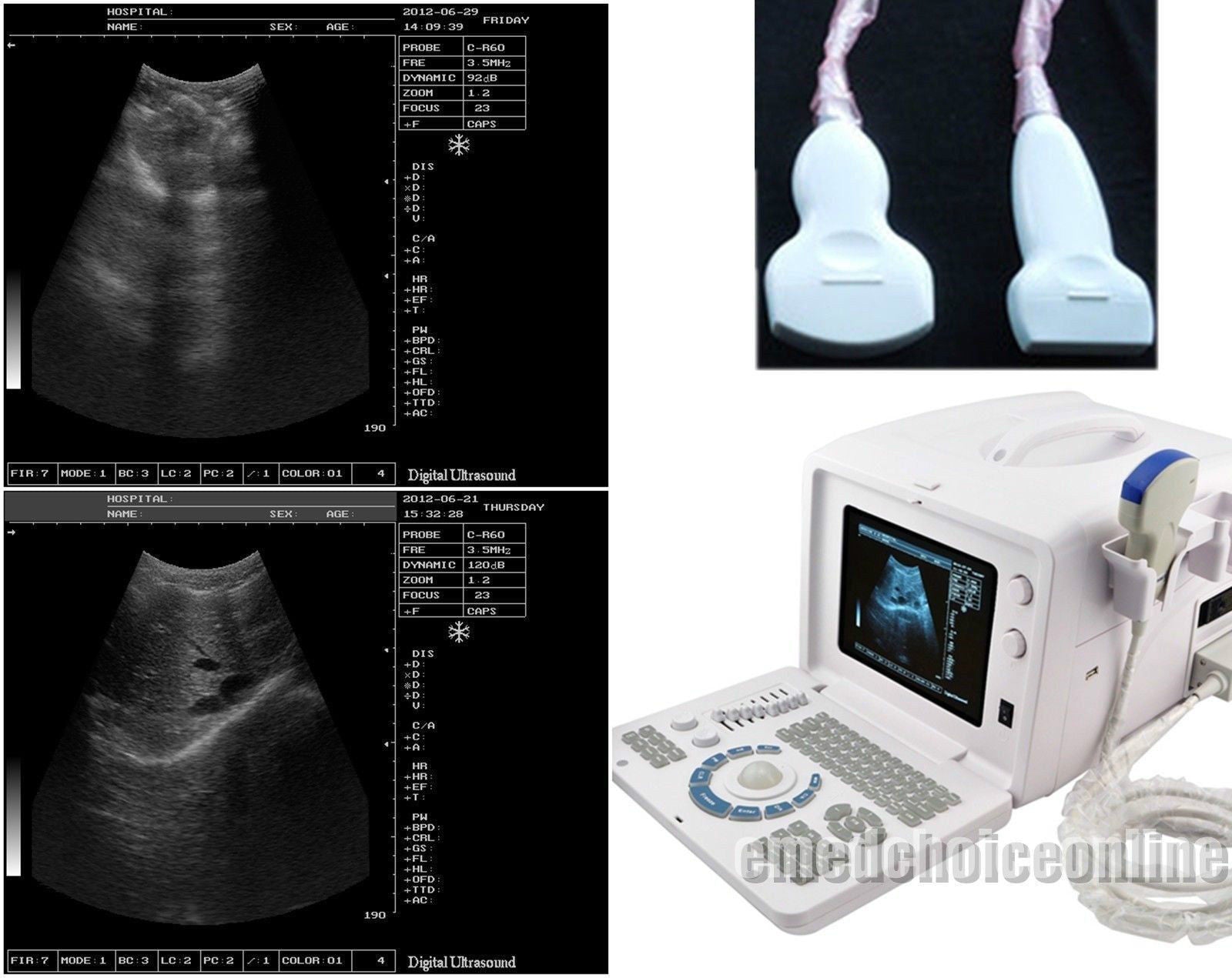 Digital Ultrasound machine Scanner  Convex + linear Probe +3D Worksation CE Sale 190891802941 DIAGNOSTIC ULTRASOUND MACHINES FOR SALE