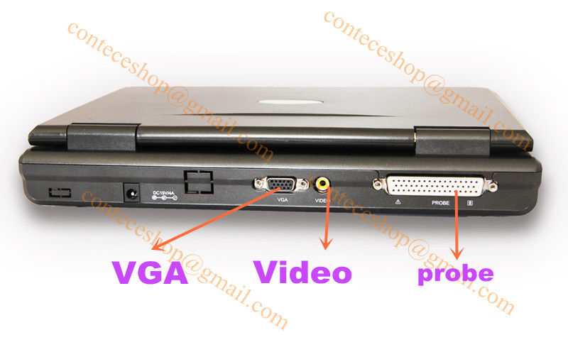 Portable laptop machine digital ultrasound scanner+probe for human,USA Warehouse DIAGNOSTIC ULTRASOUND MACHINES FOR SALE